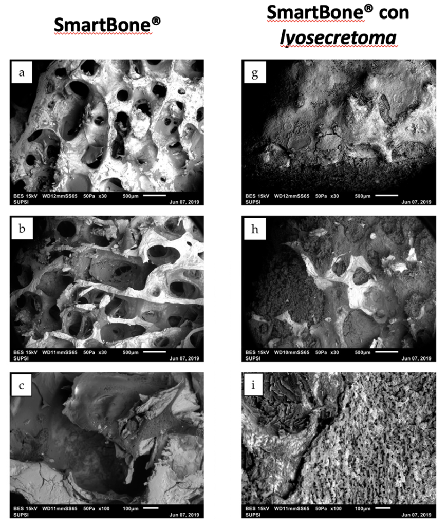 Figura 2. Immagini SEM di SmartBone® (a-c) e di SmartBone® arricchito (g-i), ingrandimenti da 30× and 100× e scale bar: 500 and 100 µm. Le immagini al microscopio evidenziano il corretto funzionamento di lyosecretoma.